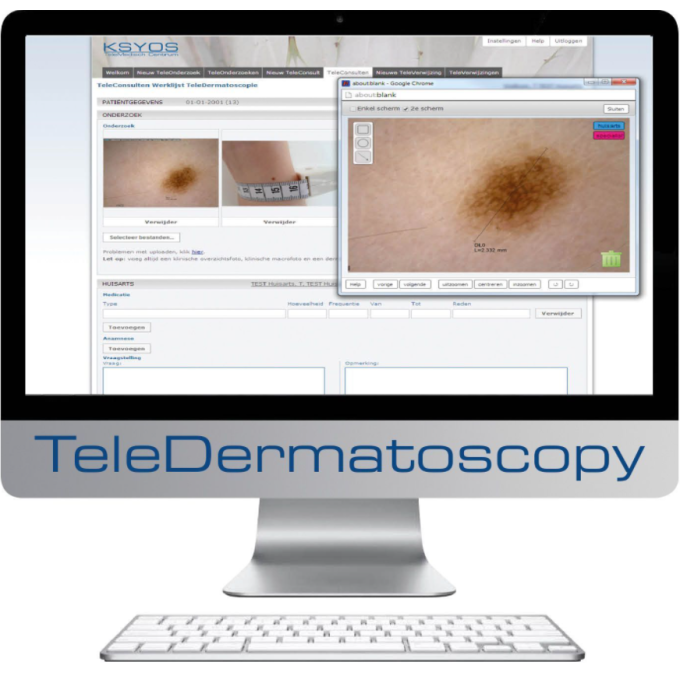Video Dermatoscop USB pentru dermatoscopie computerizata